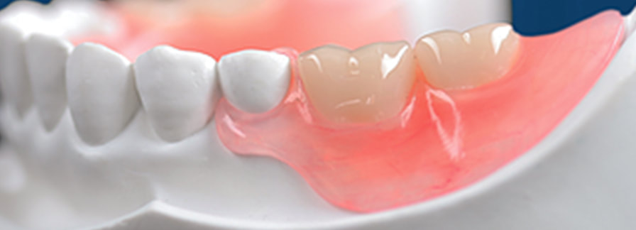 affordable dentures st catharines ontario