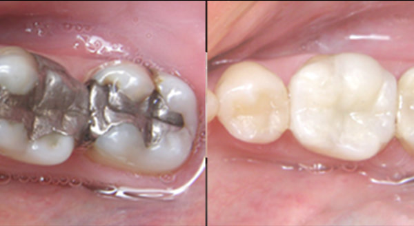 niagara dental clinic